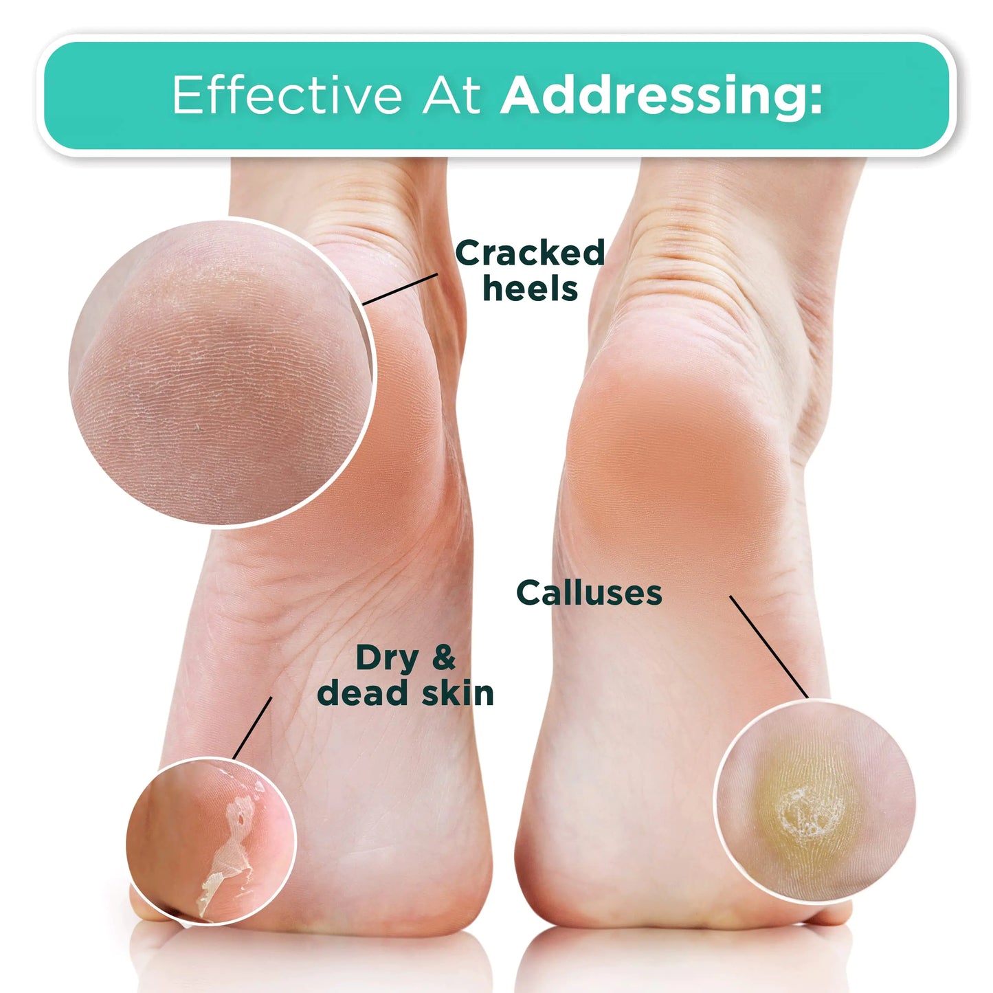 DERMORA Foot Peel Mask – 2 Pack - Kim’s Signature Beauty & Accessories    