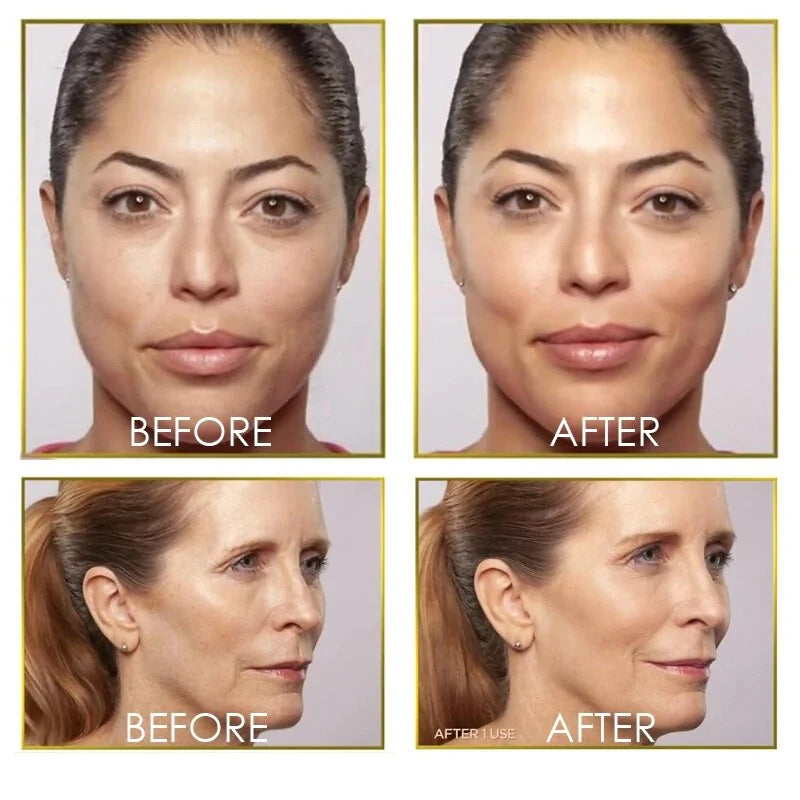 Dermaplane Face Hair Remover - Kim’s Signature Beauty & Accessories    