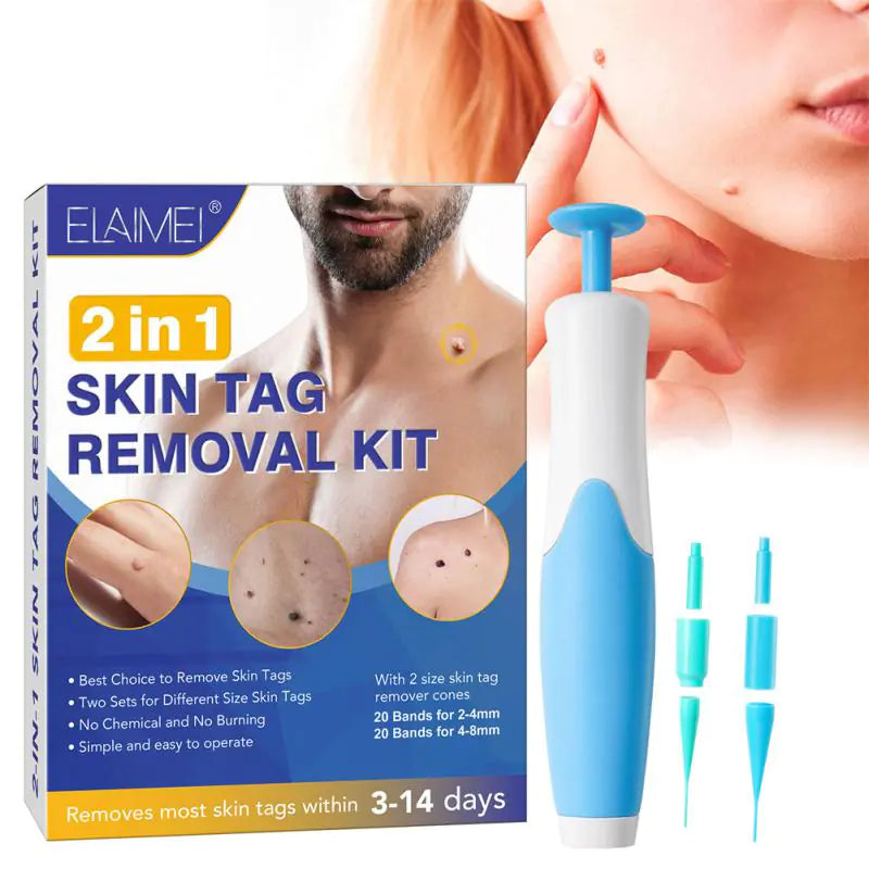 Skin Tag Remover Kit - Kim’s Signature Beauty & Accessories    (Store description)